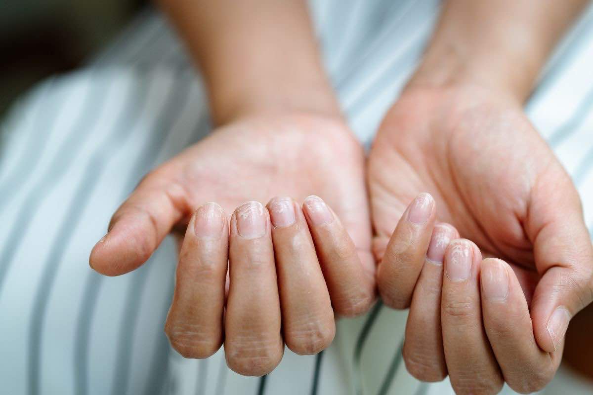 Unghie delle mani